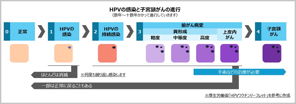 がんと感染 ヒトパピローマウイルス Hpv 2020年 コラム ニュース一覧 一般財団法人 浜松光医学財団 浜松pet診断センター